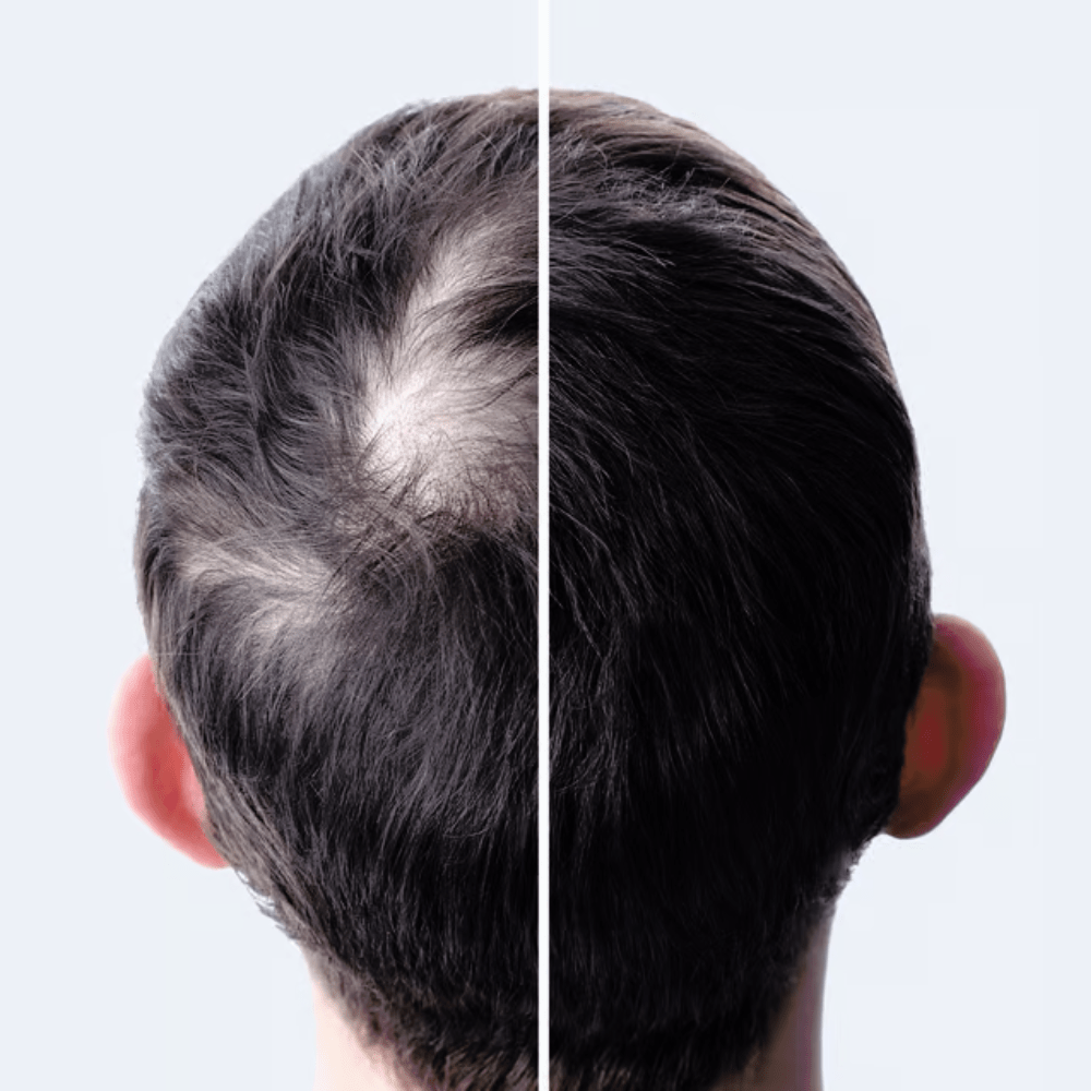 Kit Biotônico Folicular Antiqueda - Shampoo + Condicionador + Tônico Fortificante - EcoCappelle