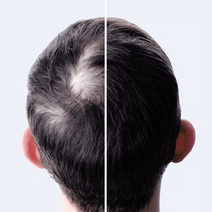 3 meses de tratamento: Kit 3 Tônicos Fortificante Capilar - EcoCappelle