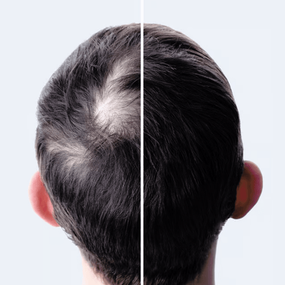 Kit Biotônico Folicular - Shampoo + Condicionador + Máscara + Leave - In + Tônico fortificante - EcoCappelle